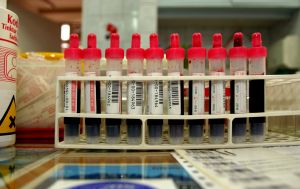 blood test
